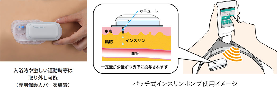 テルモ　メディセーフウィズ